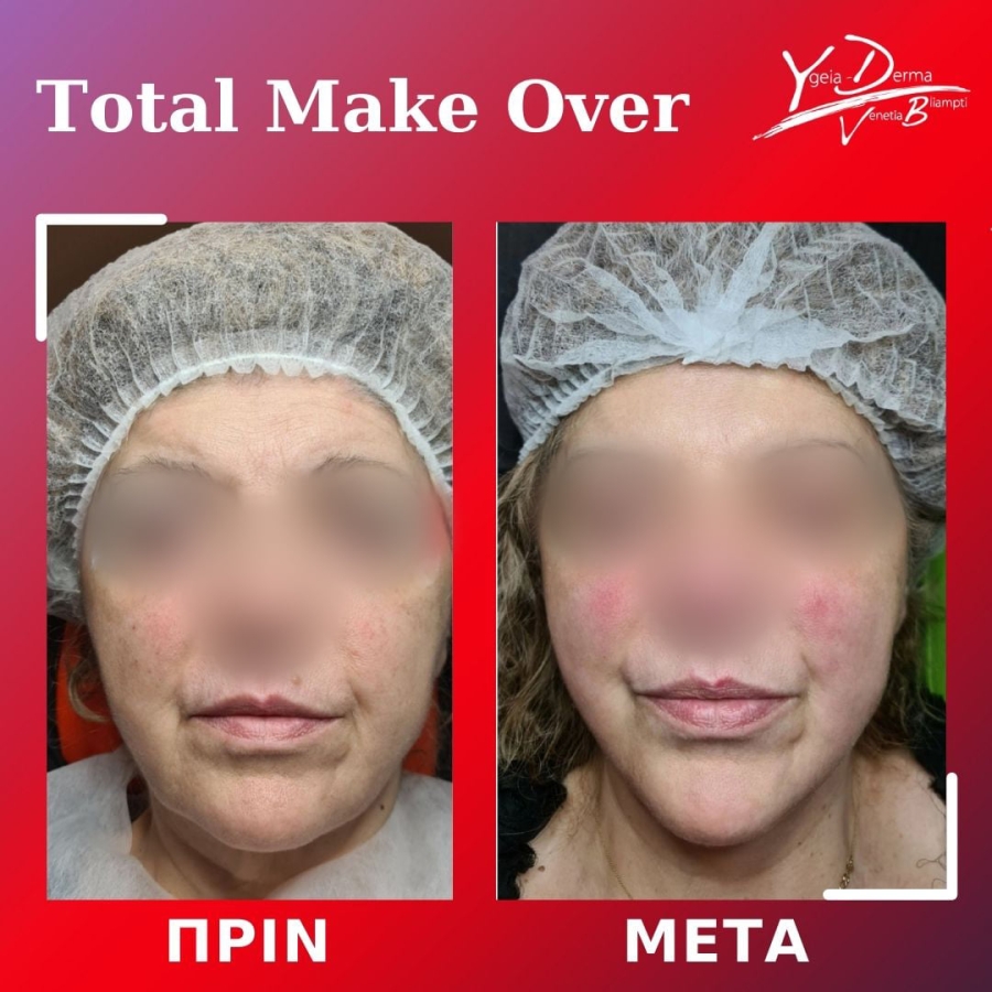 Total Make Over